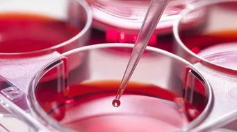 格鲁吉亚试管婴儿十大医院，小白必看！